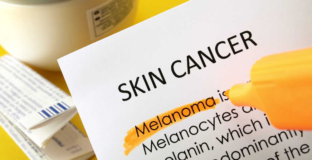 signs-and-symptoms-of-melanoma